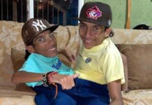 Conjoined Twins José Luis, José Armando Cevallos Dead at 27